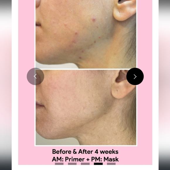 Jori Rx Acne Control Primer - Picture 3 of 5